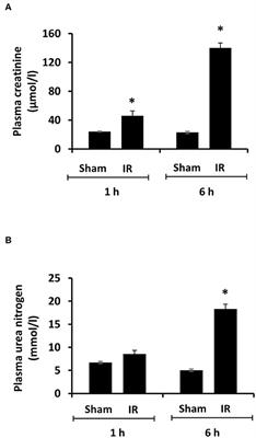 Kidney Ischemia-Reperfusion Elicits Acute Liver Injury and Inflammatory Response